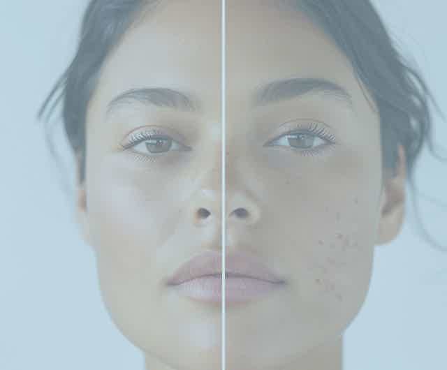 The Undiagnosed but Symptomatic