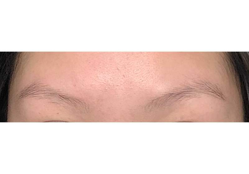marine-collagen-before-after-pictures-hair-eyebrows