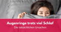 Augenringe trotz viel Schlaf - welche Ursachen sind tatsächlich verantwortlich