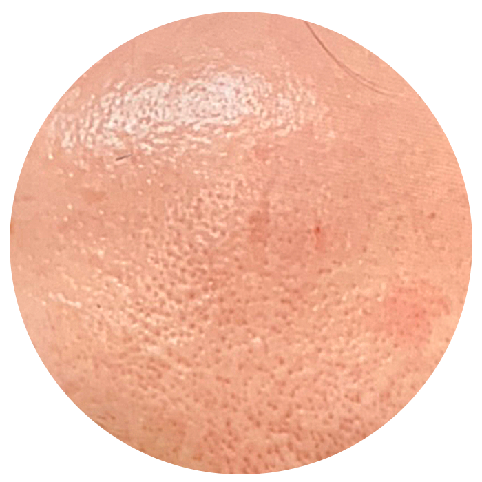 large pores before taking the best collagen supplement singapore