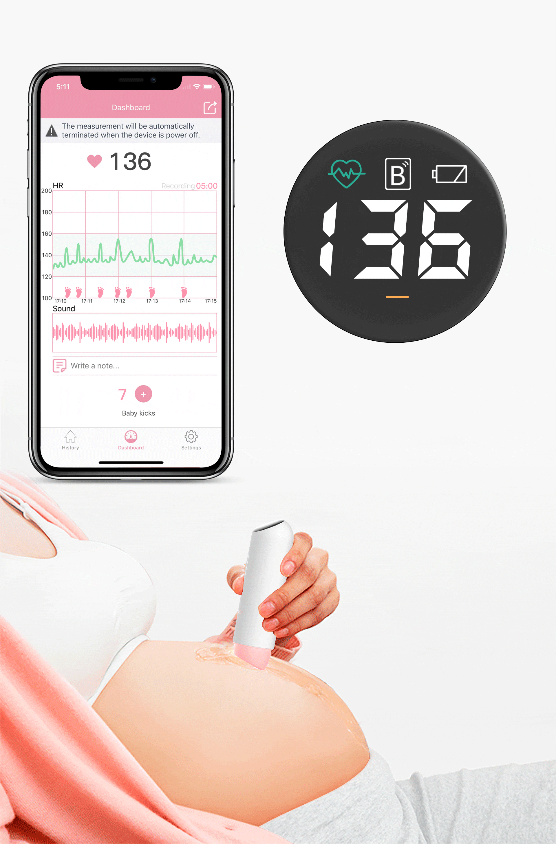 Babytone Smart Heart Monitor - and Record Your Baby's BabyTone