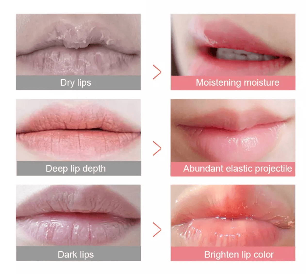 laserglow lip collagen lip repair