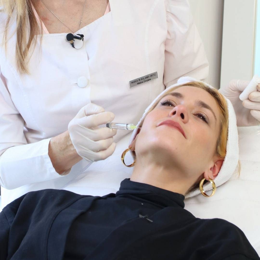 acido hialuronico estetica ojeras rinomodelacion labios pomulos buenos aires