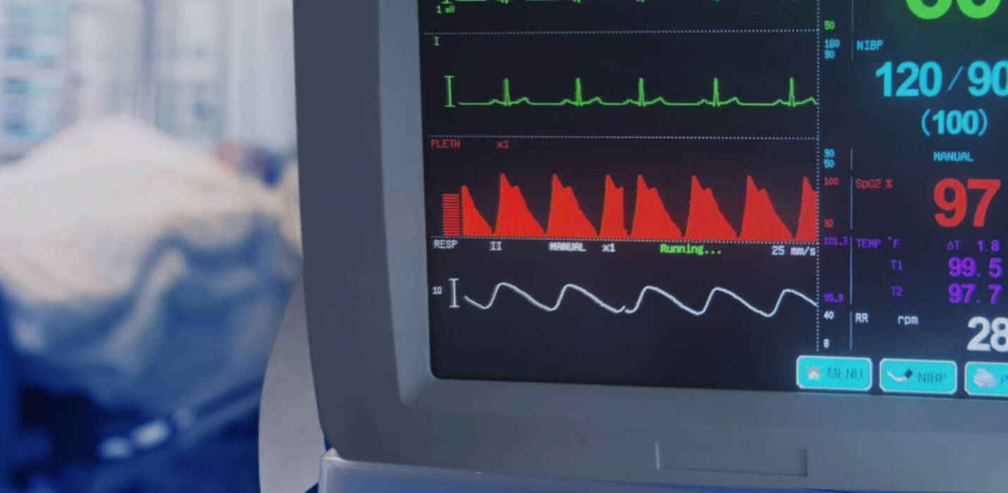 Patient Monitor