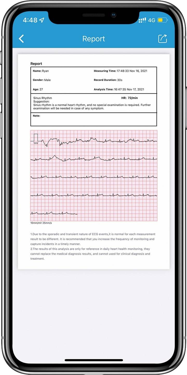 AI-EKG-Bericht