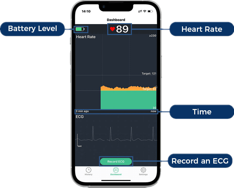 seguimiento de ECG/EKG en tiempo real