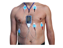 Maneras de uso del monitor Holter