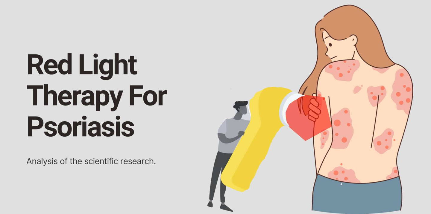 Red light therapy for psoriasis scientific research