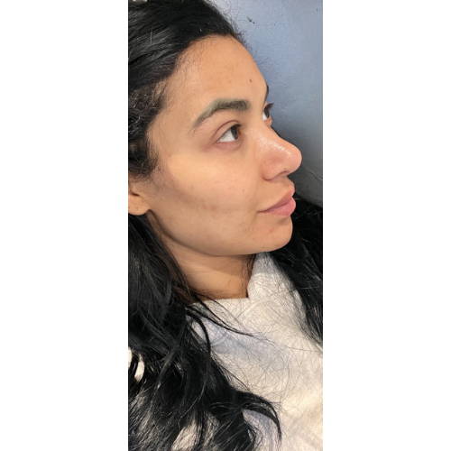 PERSONALISED MEDICAL SKINCARE AFTER