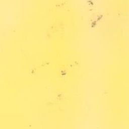 list image