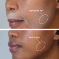 Before and after results of black women using the spray for dermaplaning