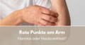 rote Punkte am Arm