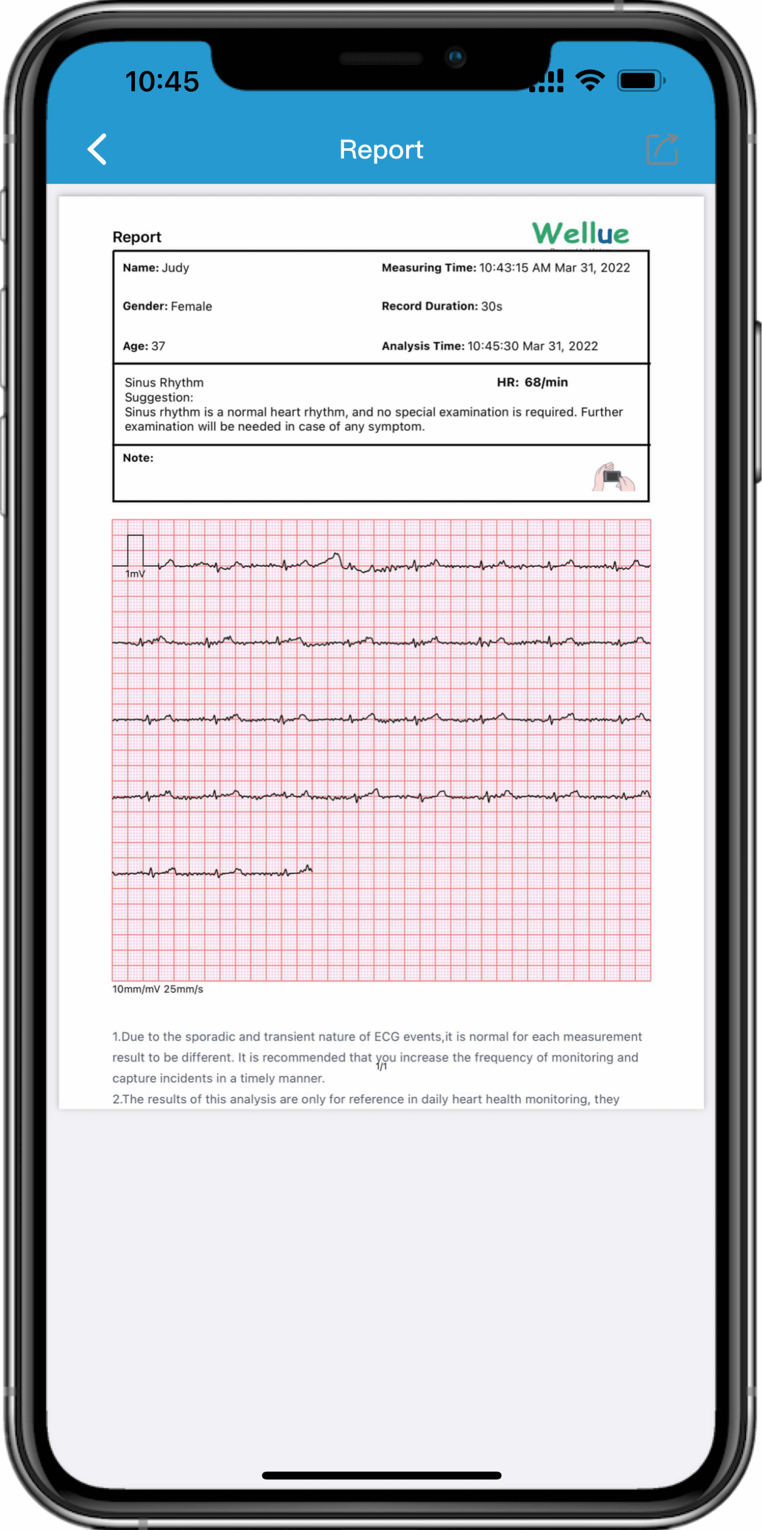 الحصول على تقارير تخطيط القلب عبر التطبيق