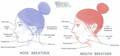 Mouth breather face diagram showing elongated face, open lips, low tongue posture
