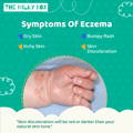 Symptoms of Eczema Graphic | The Milky Box