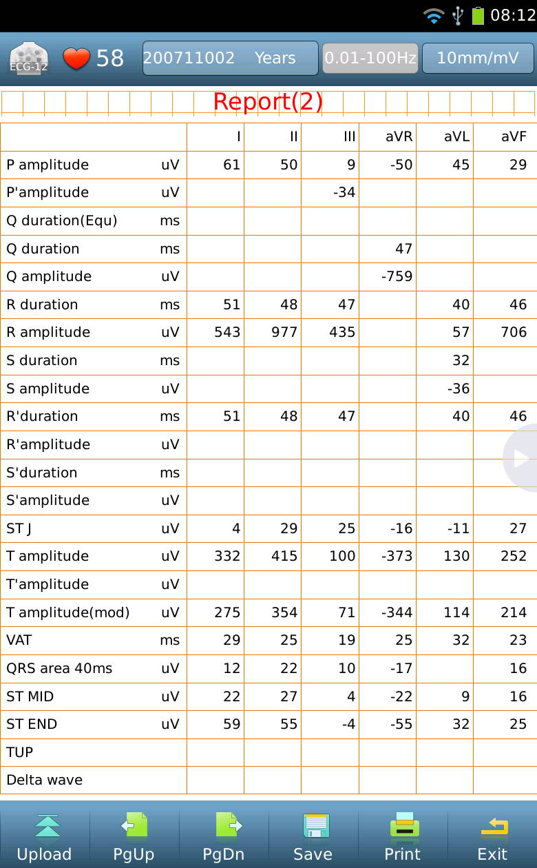 12-Lead ECG Tablet
