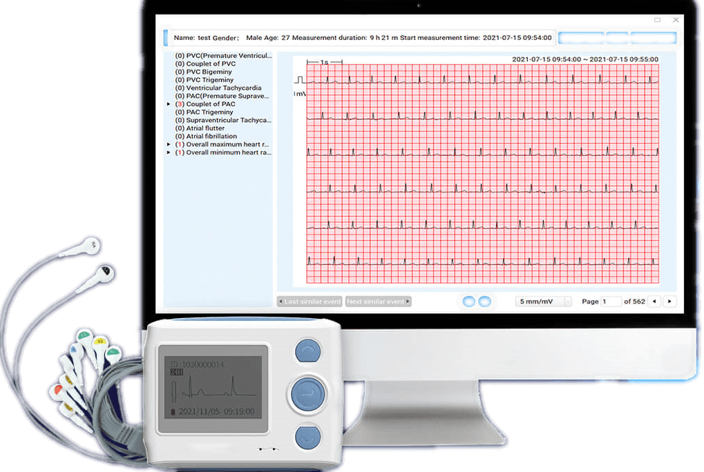 portable ecg monitor with AI analysis