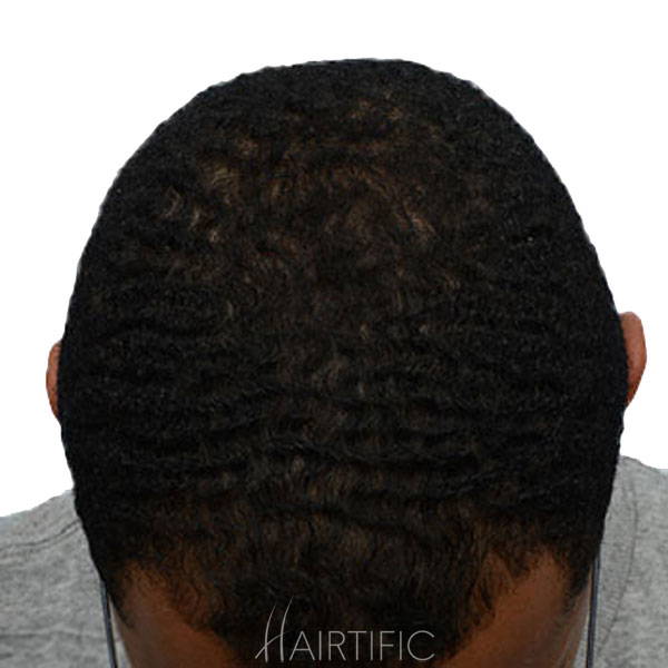 laser helmet after, laser helmet for hair growth results, laser helmet for hair growth reviews