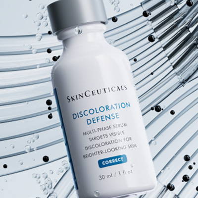 Skin Discoloration