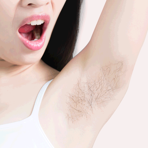 Thin Lizzy Perfect Skin Epilator - Face & Body Hair Removal