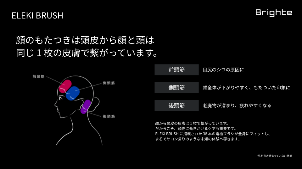 もたつき