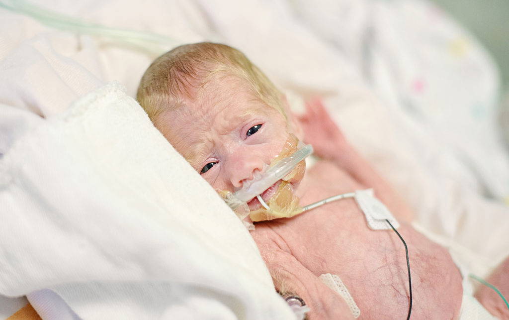 closeup preemie baby with oxygen OG tube in incubator, nicu photography