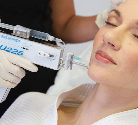 mesotherapy at medicetics skin clinic london