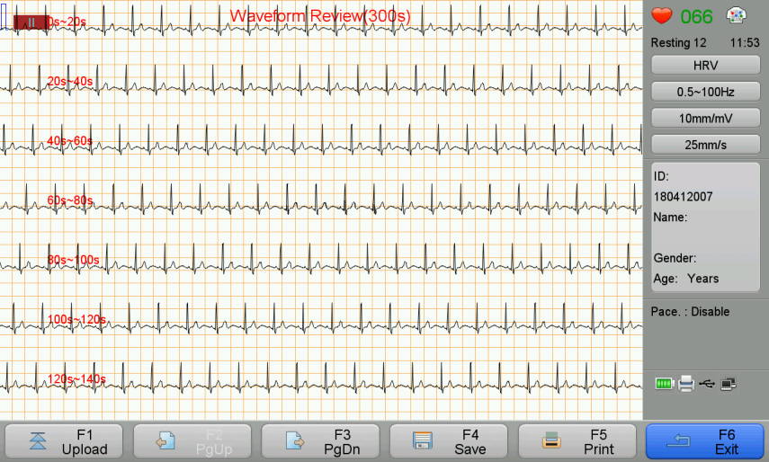 HRV waveforms acquisition and review