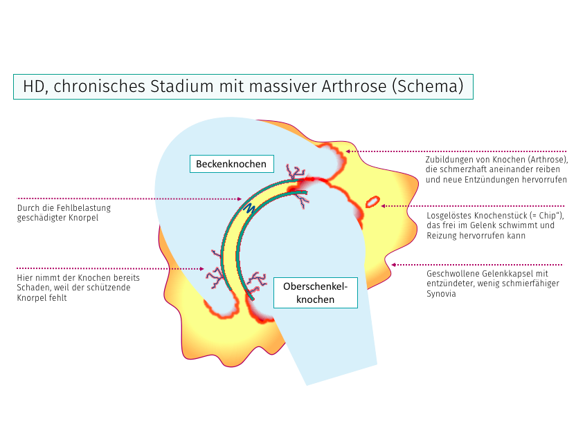 Abbildung eines Hunde-Hüftgelenks mit HD im chronischen Stadium mit massiver Arthrose