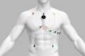 Wellue Holter-Monitor mit 12 Ableitungen