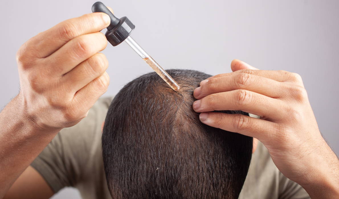 Minoxidil