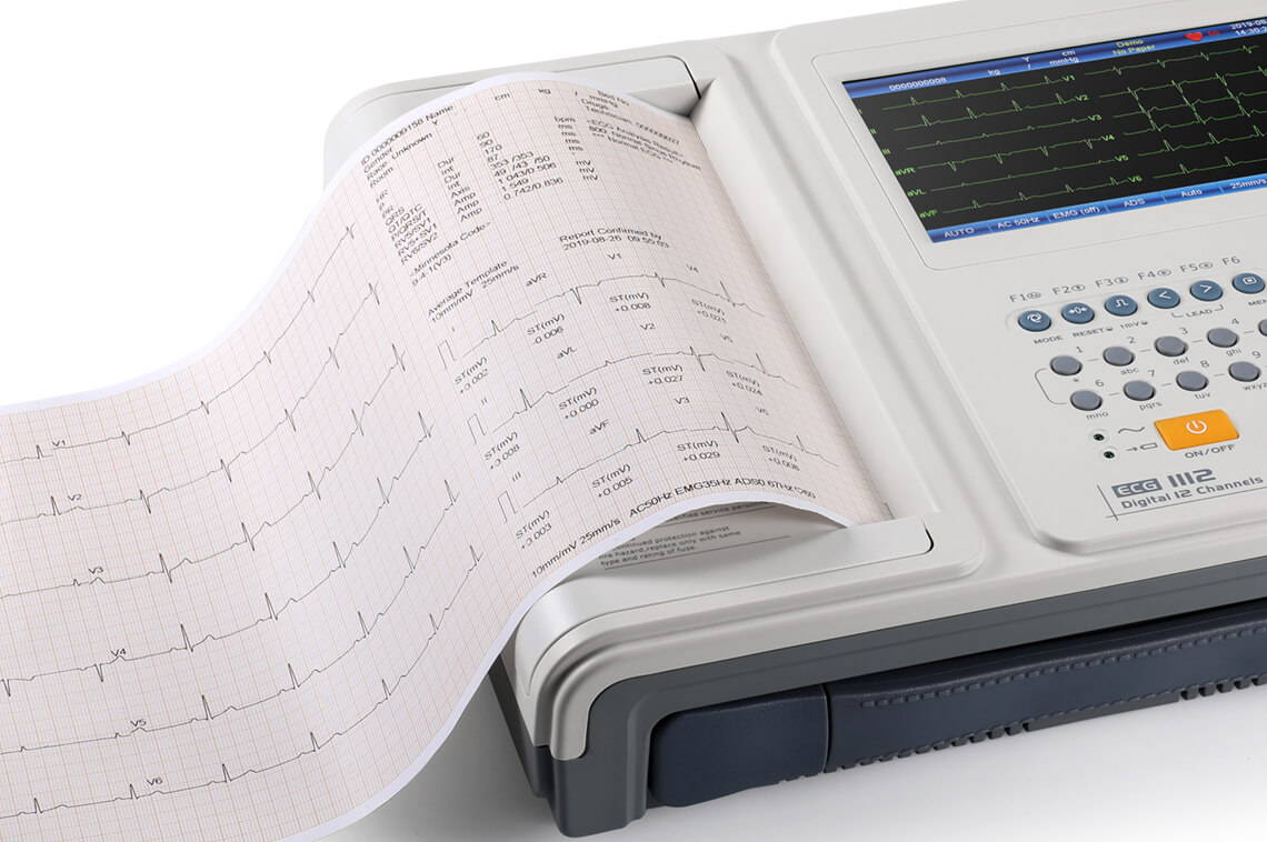 آلة ECG1112 ECG قادرة على طباعة تقارير ECG مفصلة باستخدام الطابعة المدمجة.