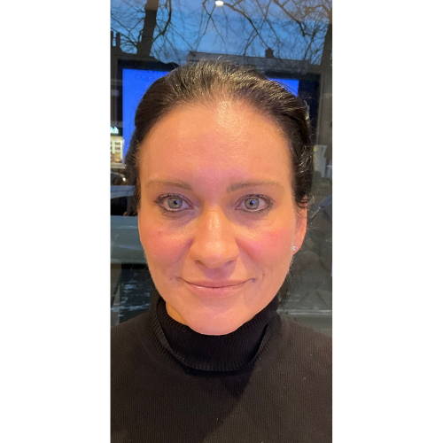 Dr Sknn CO2 Fractional Ablative Laser After