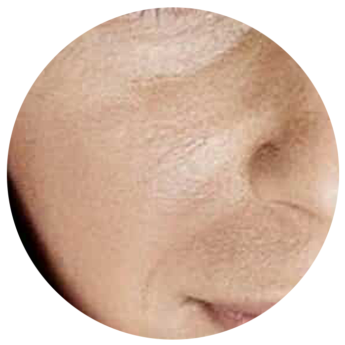 dry skin before taking the best collagen supplement singapore