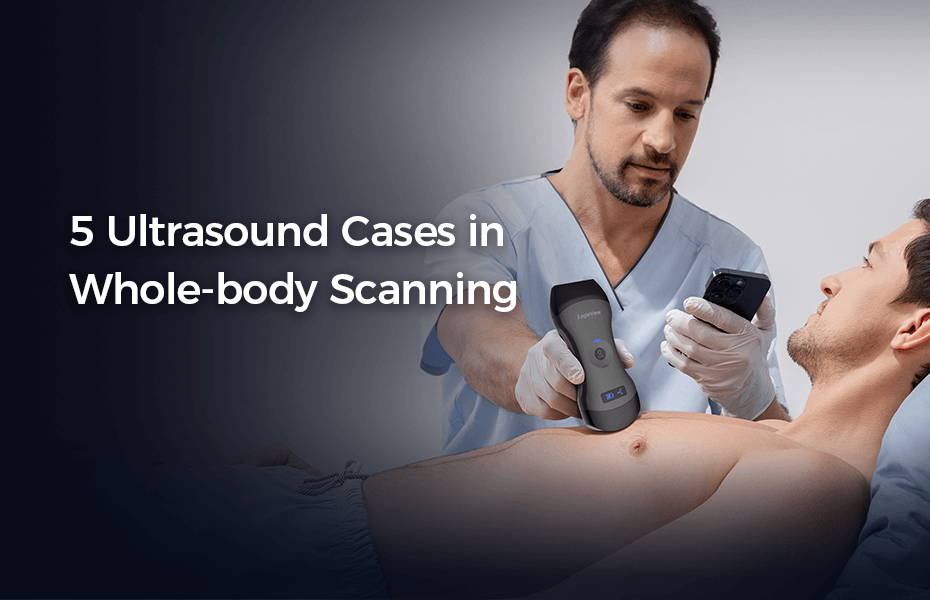 5 Eagleview Handheld Ultrasound Cases in Whole-body Scanning