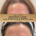 Personalised Skincare Dr Sknn Before & After Picture
