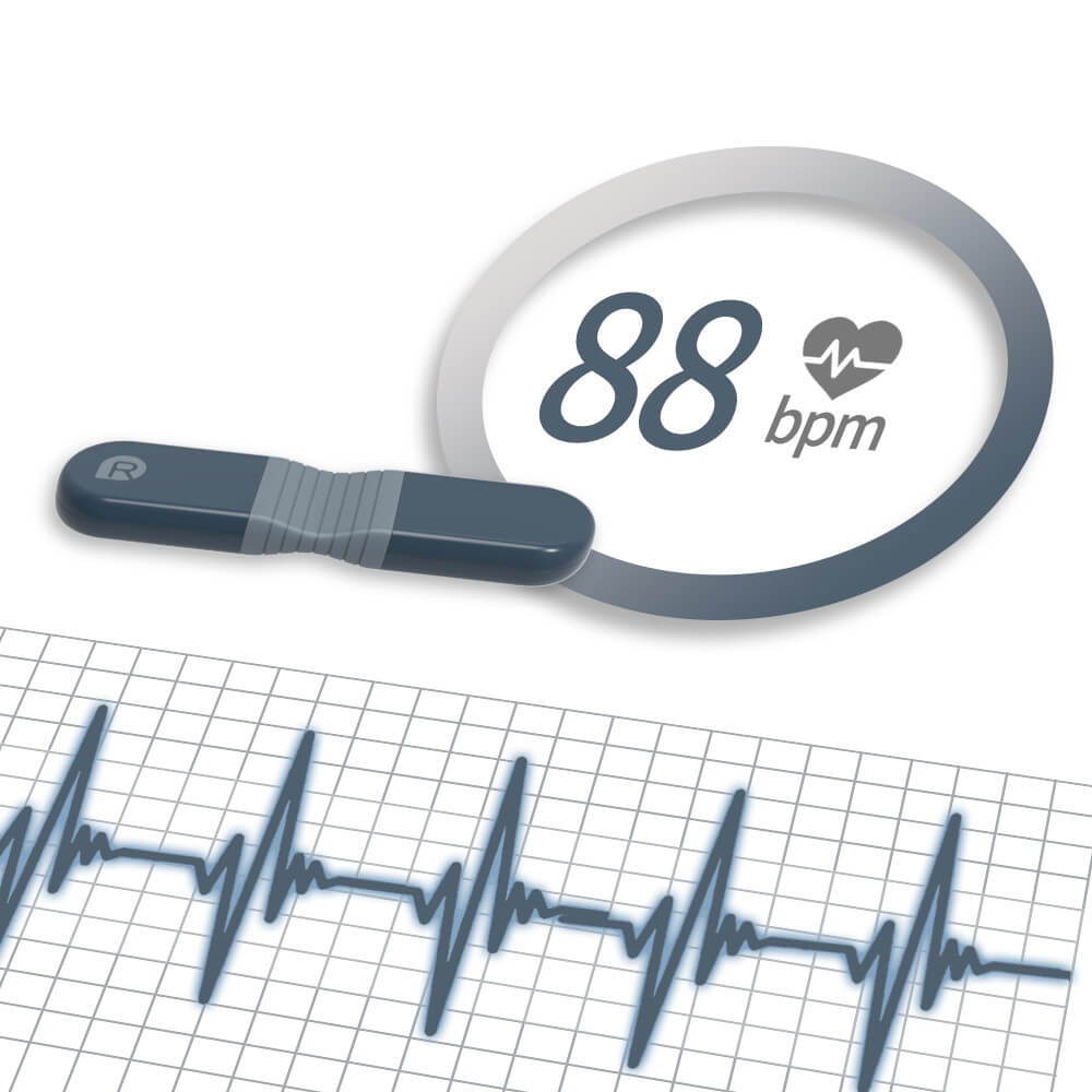 ECG monitor for 24-hour holter monitoring