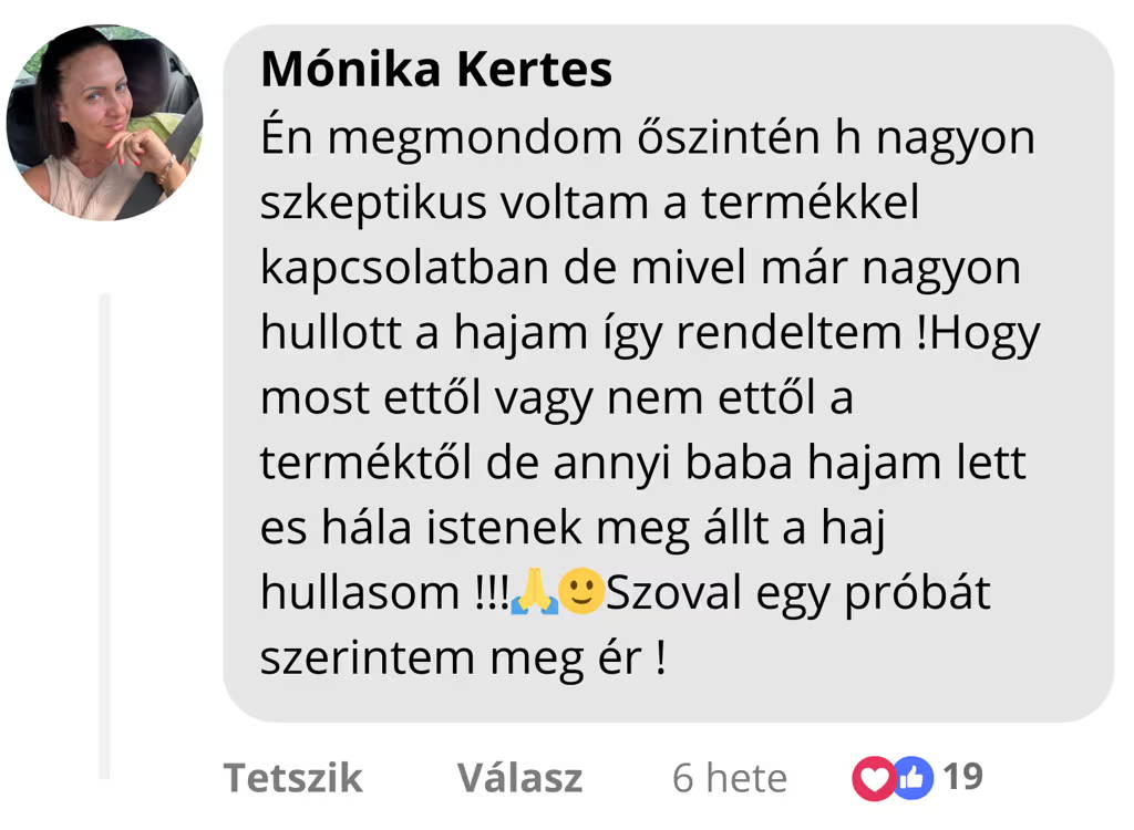 Vásárlói vélemény hajhullás csökkenésről és babahaj megjelenéséről a TheSilkyWay használata után