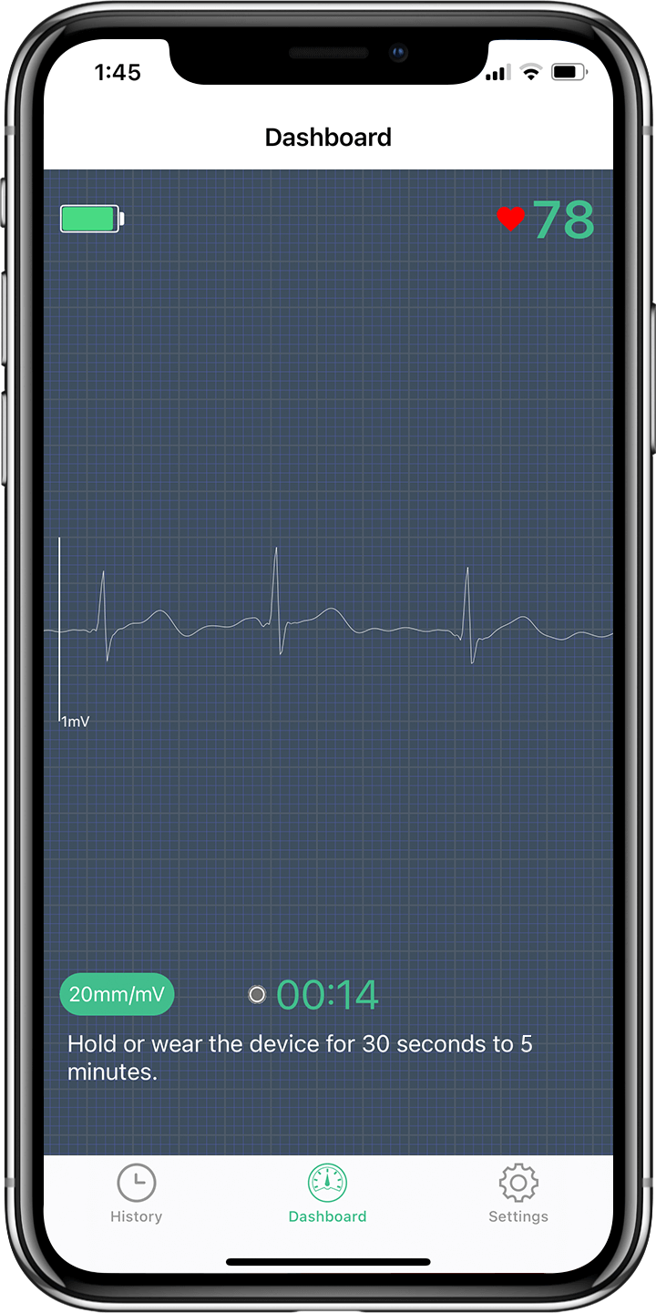 ECG/EKG en temps réel dans l'APP, surveillance ECG/EKG en temps réel, APP ECG/EKG pour Android et IOS