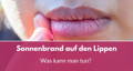 sonnenbrand auf den lippen