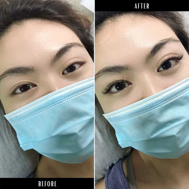 before and after lash extensions project lash studio singapore