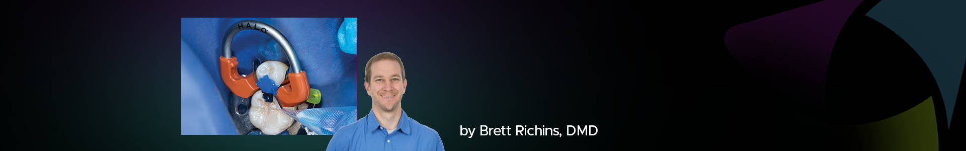 banner featuring Dr Brett Richins, DMD and a clinical image