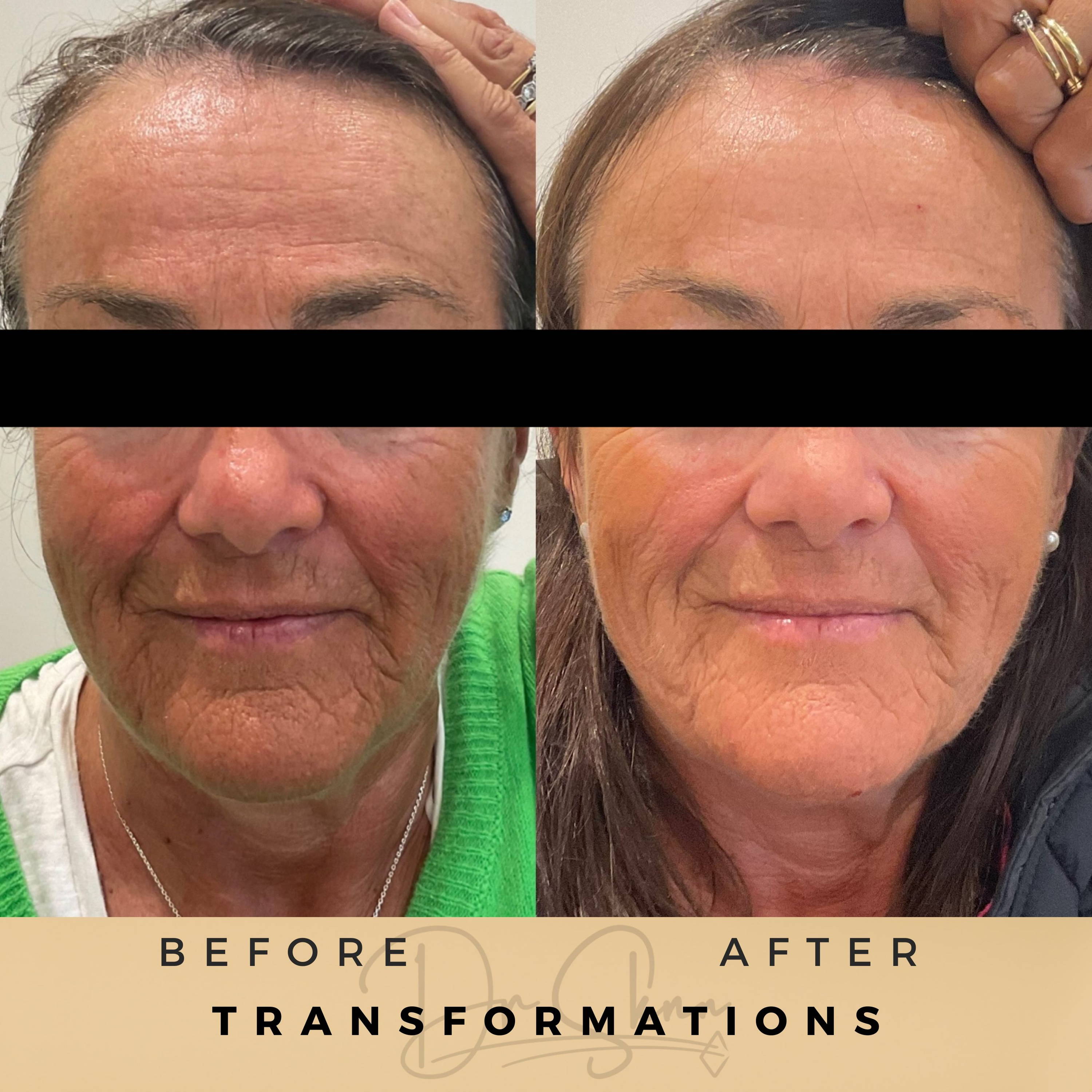 Transformations - Dr Sknn before and after