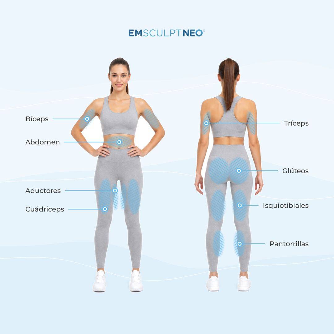 Zonas de tratamiento de Emsculpt NEO en mujer: bíceps, abdomen, aductores, cuádriceps, tríceps, glúteos, isquiotibiales y pantorrillas