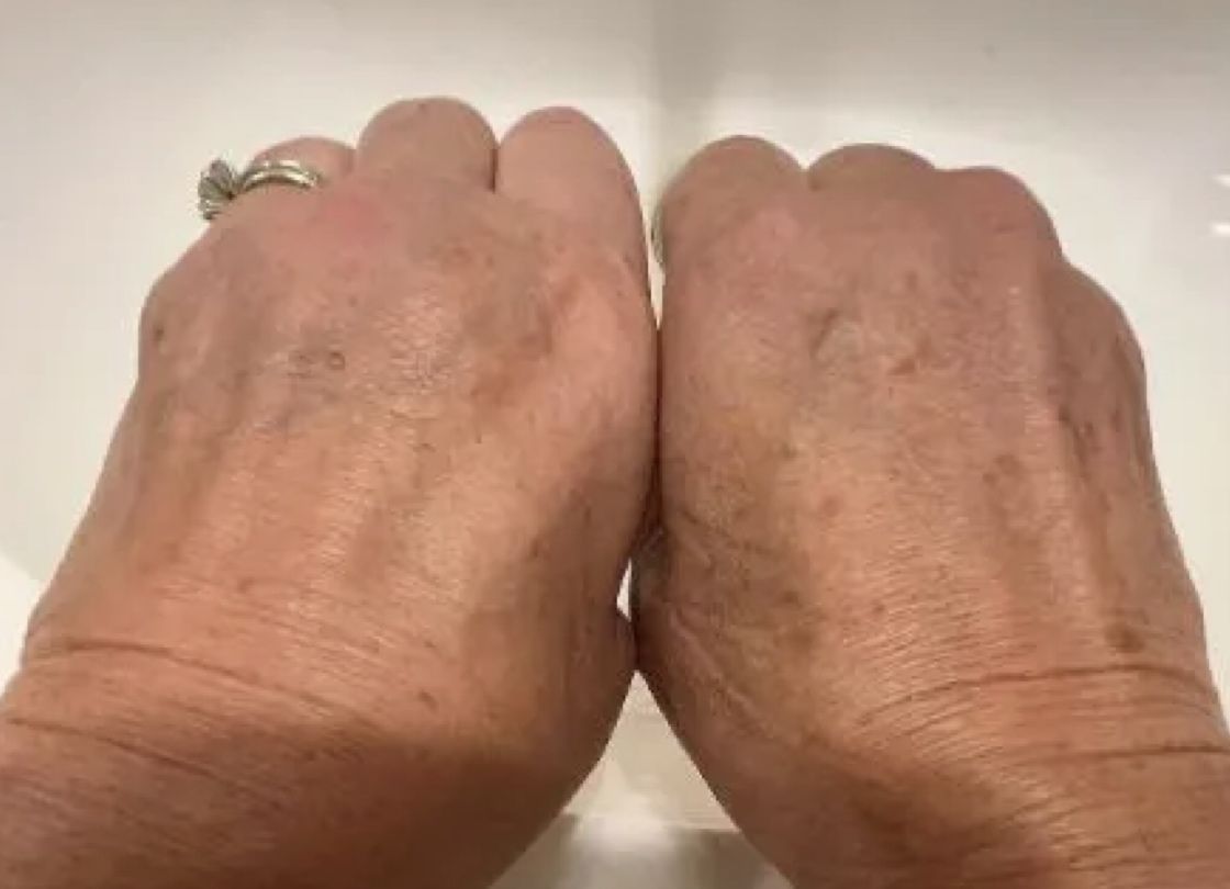 Deborah G. before and after