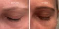 Nulastin Lash Serum Results Before After