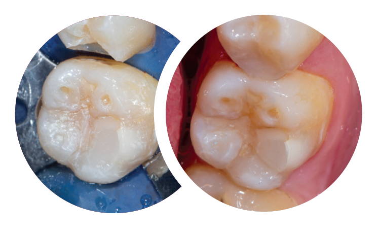 before and after restoration