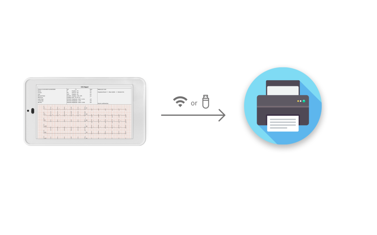La macchina ECG tascabile Wellue a 12 derivazioni consente agli utenti di trasferire i dati clinici ai laptop