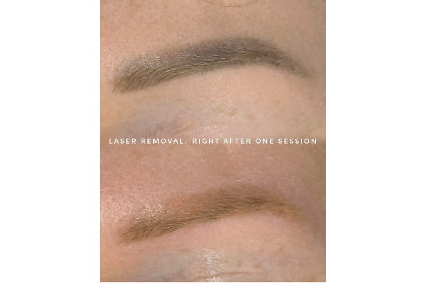 Antidote Beauty Space $10 Voucher - Image 6