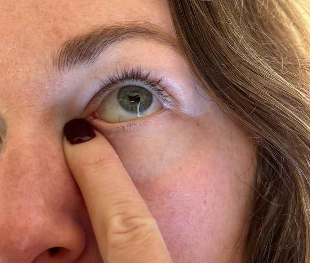 Holding pressure in this area can prevent eye drop medication from draining through the nose and into the rest of the body